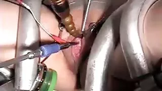 Urinrøret klingende med e-stim